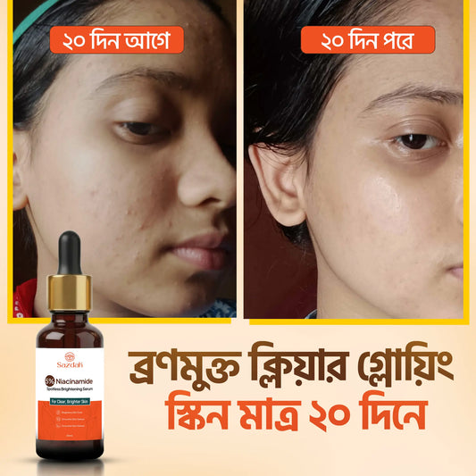 5% Niacinamide Spotless Brightening Serum